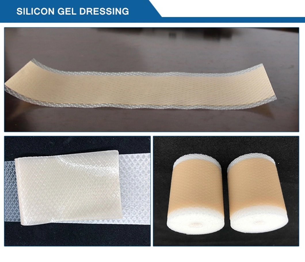 Medical Hydrocolloid Dressings Hydrocolloid Acne Dressing